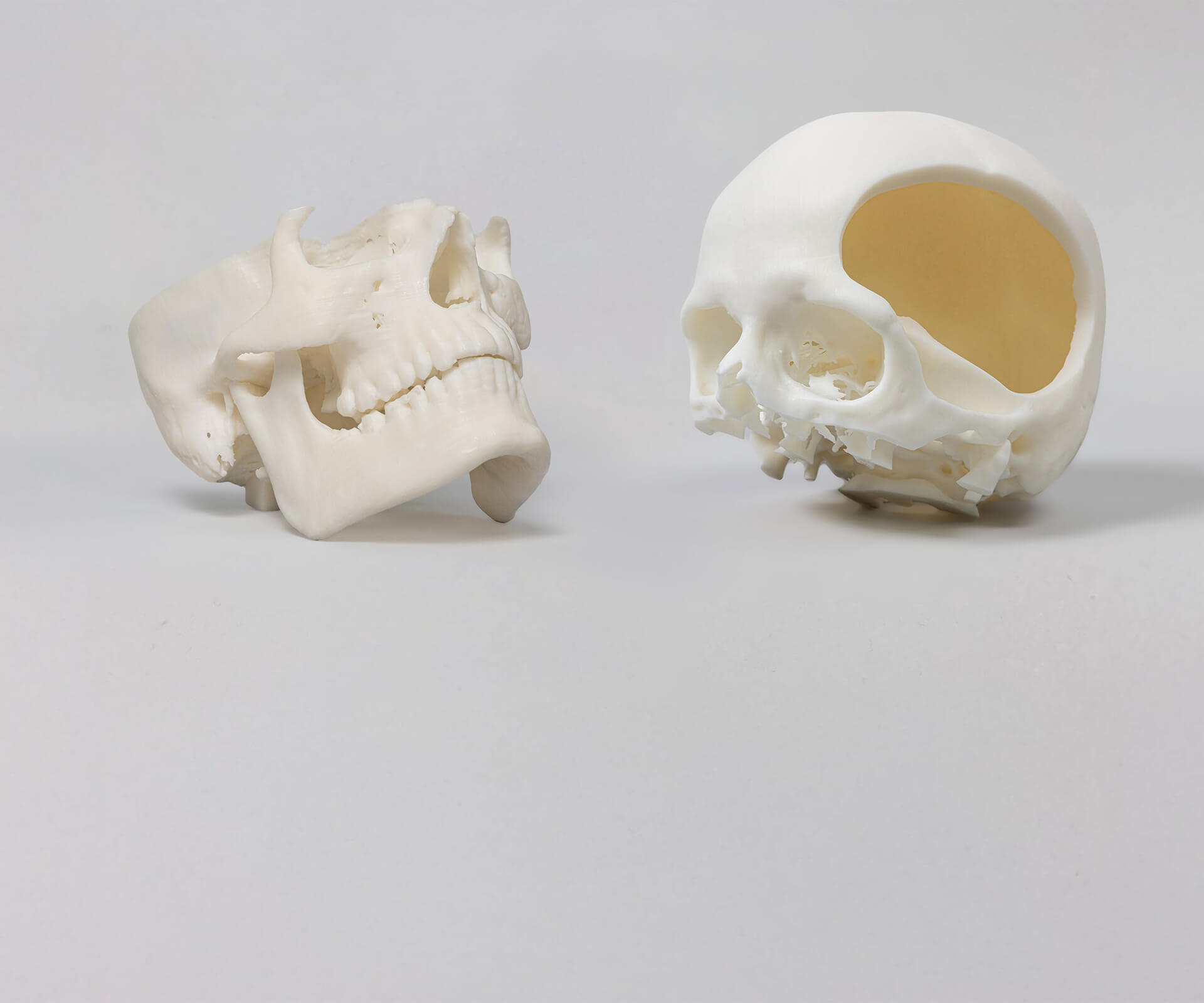 Teaser-Hartgewebemodelle